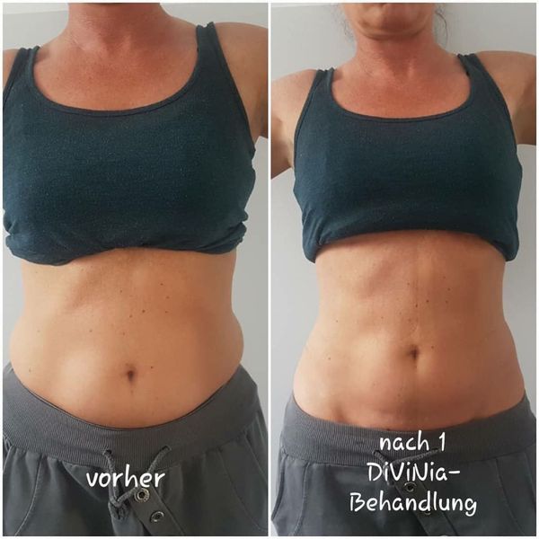 Vorher Nachher Bilder Meine Website